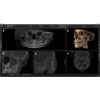 Sirona Axeos 3D (17x13) – Дентальный томограф | Dentsply-Sirona / Germany