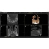 Sirona Axeos 3D (17x13) – Дентальный томограф | Dentsply-Sirona / Germany