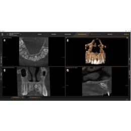 Sirona Axeos 3D (17x13) – Дентальный томограф