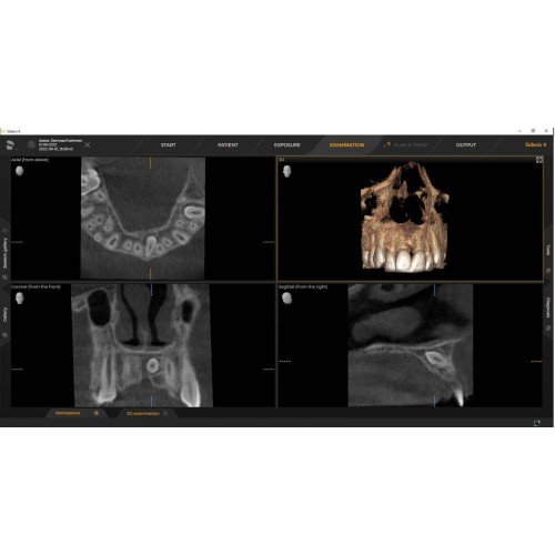 Sirona Axeos 3D (17x13) – Дентальный томограф | Dentsply-Sirona / Germany