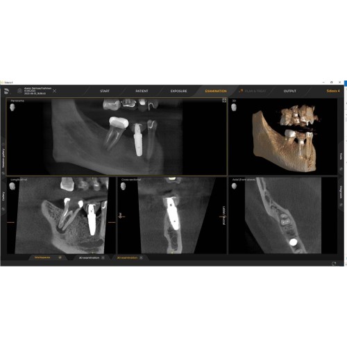 Sirona Axeos 3D (17x13) – Дентальный томограф | Dentsply-Sirona / Germany