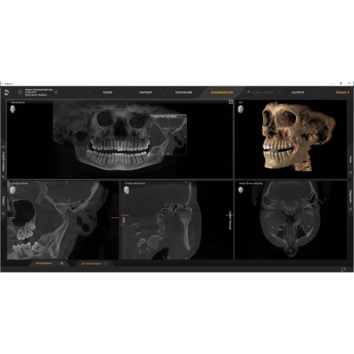 Sirona Axeos 3D (17x13) – Дентальный томограф | Dentsply-Sirona / Germany