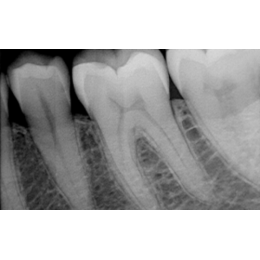 Fona StarX PRO (Италия)