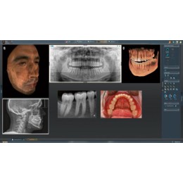 Sirona Orthophos SL 3D (11x10)