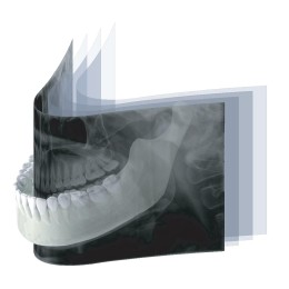 Genoray Papaya ортопантомограф (Ю.Корея)