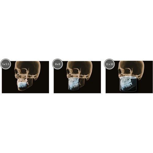 Sirona Orthophos SL 3D (11x10) – Дентальные томографы Sirona (Германия)