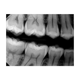 Kodak RVG 6200 (США)