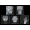 GENORAY Papaya 3D 23x24 - компьютерный томограф с цефалостатом One Shot 60-69 кВ (GENORAY (Ю. Корея))