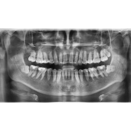 Sirona Orthophos XG 3 DS – Ортопантомограф