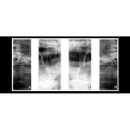 Planmeca ProOne - универсальный цифровой ортопантомограф