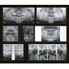 GENORAY Papaya 3D 23x24 - компьютерный томограф с цефалостатом One Shot 60-69 кВ (GENORAY (Ю. Корея))