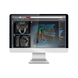 Sirona Orthophos SL 3D (11x10)