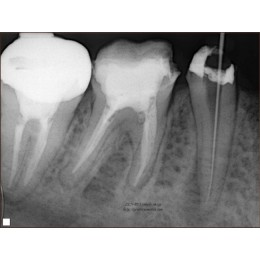 Genoray PORT-X II Портативный рентген (Ю.Корея)