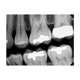 Kodak RVG 6200 (США)