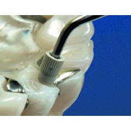 C20 насадка F00113 к скалеру 