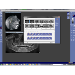 Sirona Orthophos XG 3 DS – Ортопантомограф