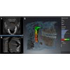 Sirona Orthophos SL 3D (11x10) – Дентальные томографы Sirona (Германия)