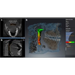 Sirona Orthophos SL 3D (11x10)