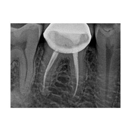 Kodak RVG 5200 (США)