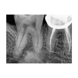 Kodak RVG 5200 (США)