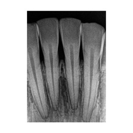 Kodak RVG 5200 (США)